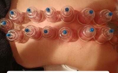 Schröpfmassage – eine Wohltat für erschöpfte Mütter / Väter